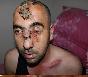 Sarıgazi'de Polisler  önce dövdü, gözünü çıkardıktan sonra ateşin üzerine atarak terk etti. 